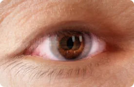 diplopia-rendering