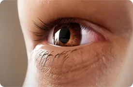 photophobia-rendering